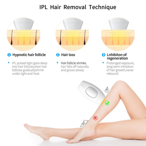 IPL Laser Hair Removal - skintoy